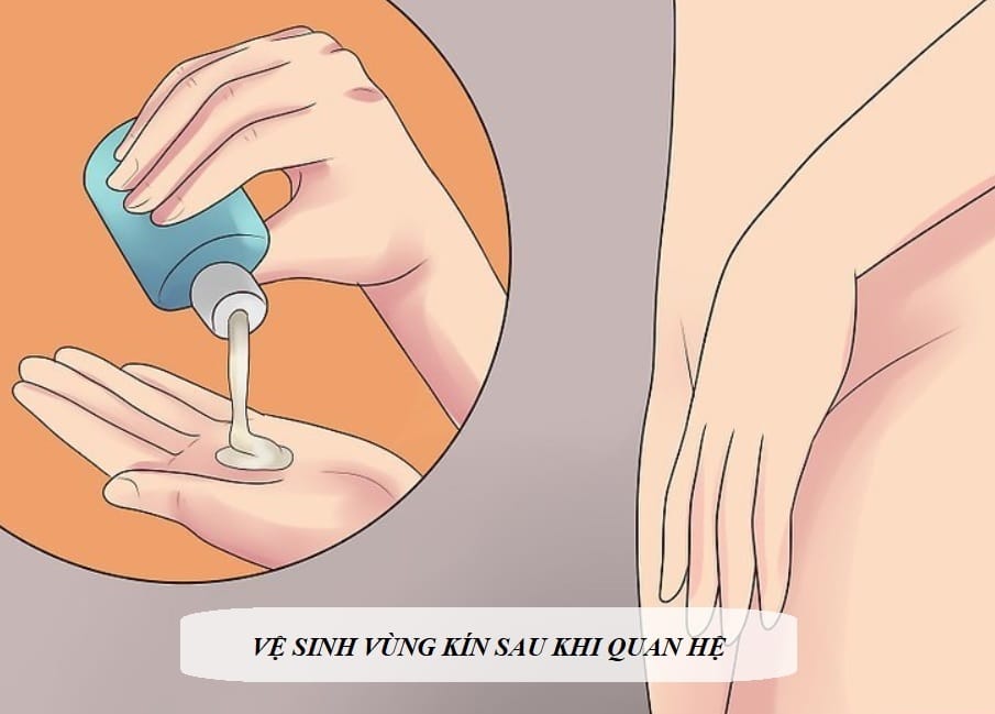 Sau Khi Quan Hệ Có Nên Rửa Vùng Kín Không